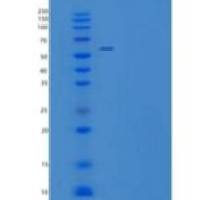 小鼠EphB4 / HTK重组蛋白His tag