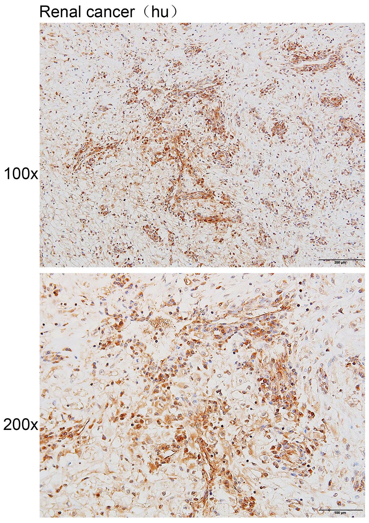 Anti-SLC3A1 Polyclonal Antibod