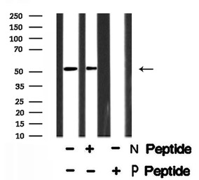 Steroidogenic Factor 1 (phosph
