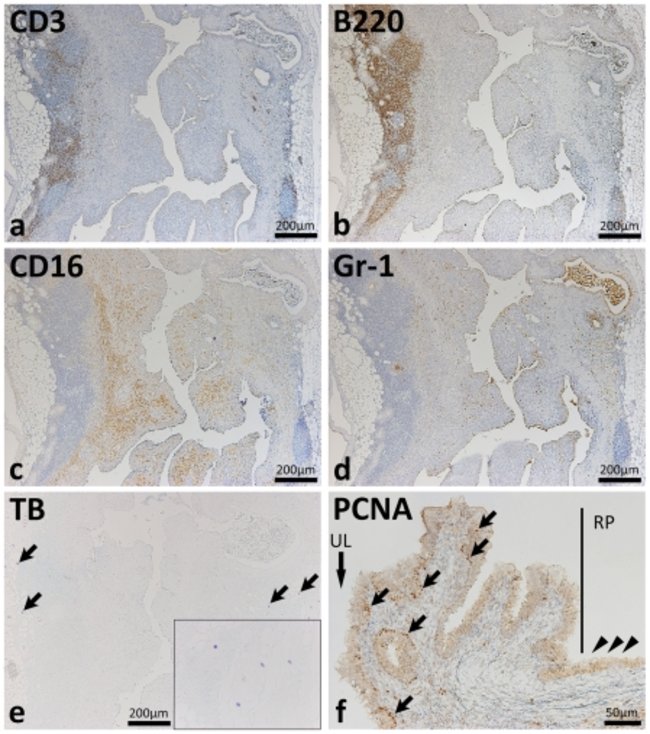 CD3 Antibody