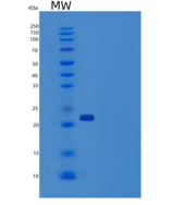 人CD32a / FCGR2A重组蛋白167 Arg, Hi