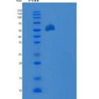 小鼠EphB3 / HEK2重组蛋白His tag