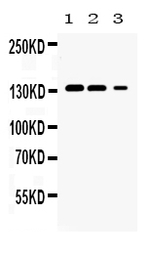 JAK1 antibody
