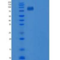 人肝配蛋白B受体6(EPHB6)重组蛋白Fc tag