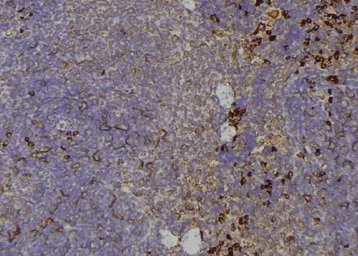 TIE2 (phospho Tyr992) antibody