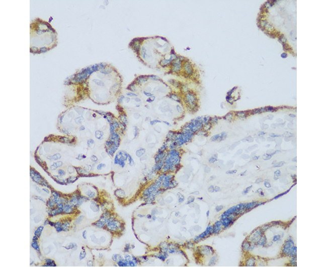 CYP11A1 Rabbit Polyclonal Anti