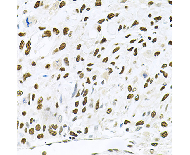 JNK1/MAPK8 Rabbit Polyclonal A