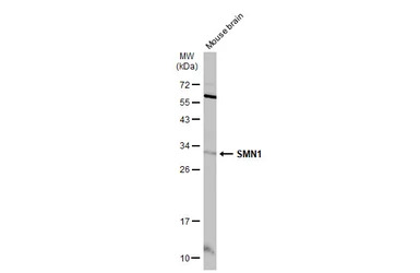SMN1 antibody