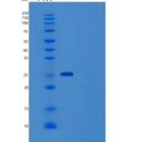 人IgG2-Fc重组蛋白257 Ser/Ala