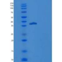 人TGFBR1 / ALK-5 / SKR4重组蛋白His & Fc tag