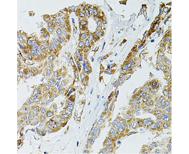 SIRT3 Rabbit Polyclonal Antibo