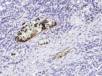 S100A12 antibody [133]