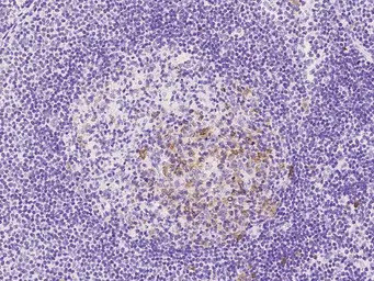 UBE2S antibody