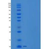 人血管内皮生长因子/促动素-1重组蛋白His Tag