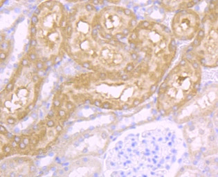 CD46 antibody [JB25-49]