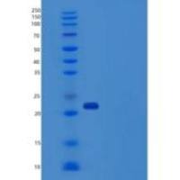 人CD32a / FCGR2A重组蛋白167 Arg, His tag