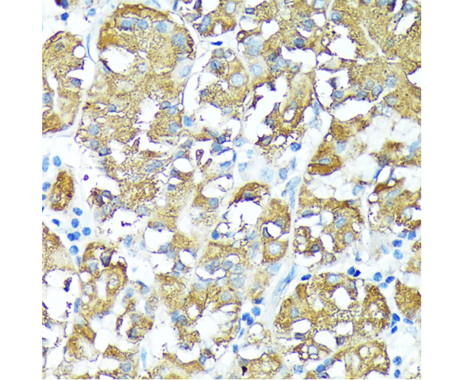 TNFR1 Rabbit Polyclonal Antibo