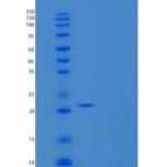 人CD32a / FCGR2A重组蛋白 (167 Arg, His & AVI tag), Biotinylated
