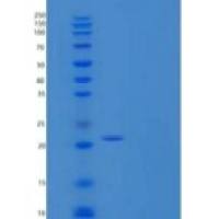 人CD32a / FCGR2A重组蛋白 (167 Arg, His & AVI tag), Biotinylated