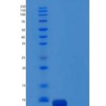 人C-C基序趋化因子26/ccl 26（27-94）重组蛋白