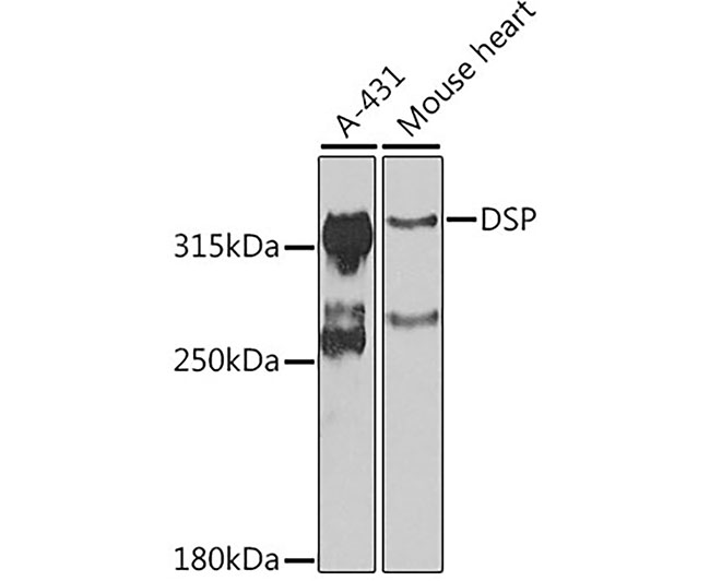 DSP Rabbit Polyclonal Antibody