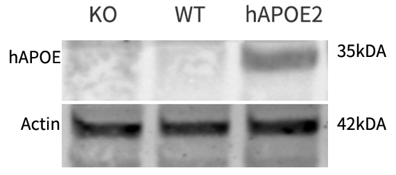 Apoe2-4.png Apoe2-4.png