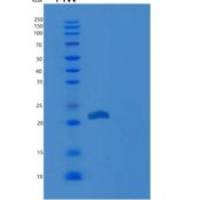 人生长激素1（GH1 ）重组蛋白