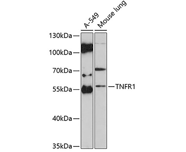 TNFR1 Rabbit Polyclonal Antibo