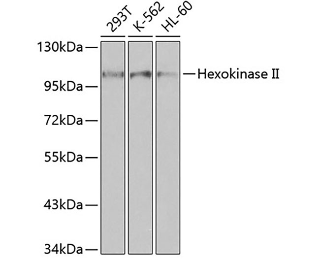 Hexokinase II Rabbit Polyclona
