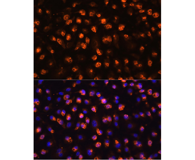 CD11B Rabbit Polyclonal Antibo