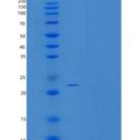 人CEACAM21 重组蛋白C-6His