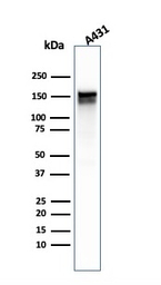 EGFR antibody [GFR/1667]