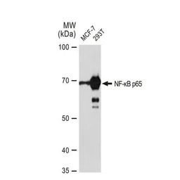 NFkB p65 antibody [GT1185]