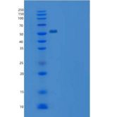 大鼠IL7R / IL7RA重组蛋白Fc tag