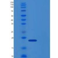 人UBE2D4 重组蛋白His Tag