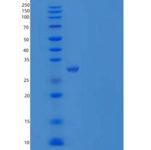 人磺基转移酶4A1/SULT4A1重组蛋白