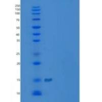 人触珠蛋白/Zonulin重组蛋白C-6His