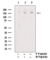 TIE2 (phospho Tyr992) antibody