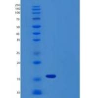人半胱氨酸蛋白酶抑制剂1(CST1)重组蛋白C-6His