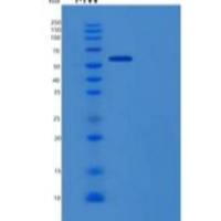 人肝配蛋白B受体6(EPHB6)重组蛋白His tag