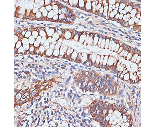 PIGR Rabbit Polyclonal Antibod