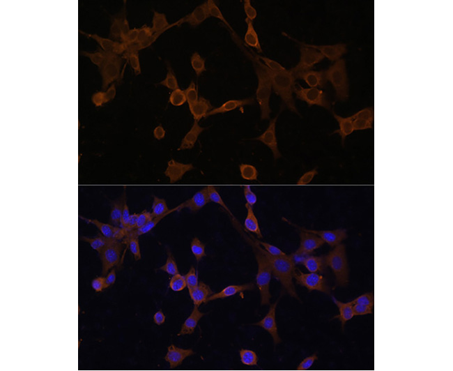 BID Rabbit Polyclonal Antibody