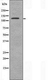 ALPK1 antibody