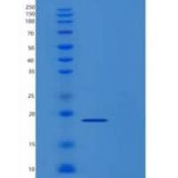 人M-CSF / CSF-1重组蛋白