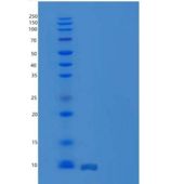 人白细胞介素-8/CXCL8重组蛋白aa 28-99