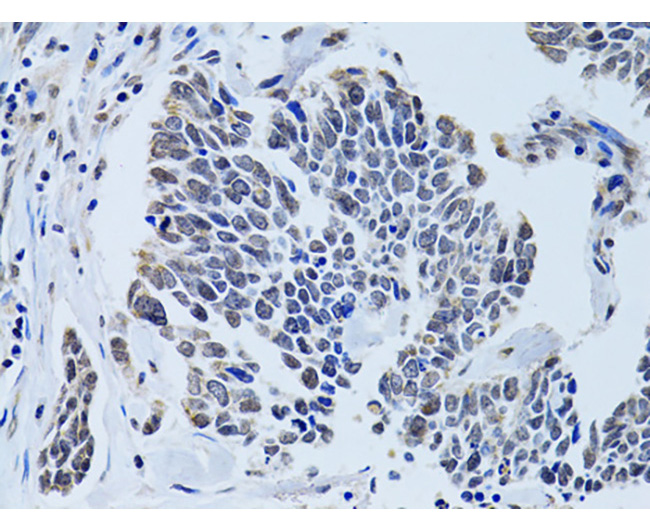 SIN3A Rabbit Polyclonal Antibo