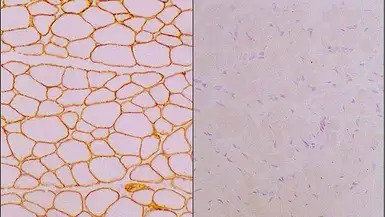 Laminin alpha 2 antibody [Mer3