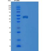 人生长抑制特异性蛋白7/GAS-7/KIAA0394重组蛋白N-6His