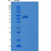 人生长抑制特异性蛋白7/GAS-7/KIAA0394重组蛋白N-6His