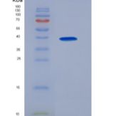 人巨噬细胞炎性蛋白1α(MIP1a)重组蛋白